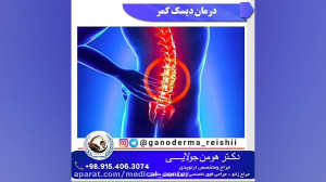 نحوه درمان خانگی دیسک کمر