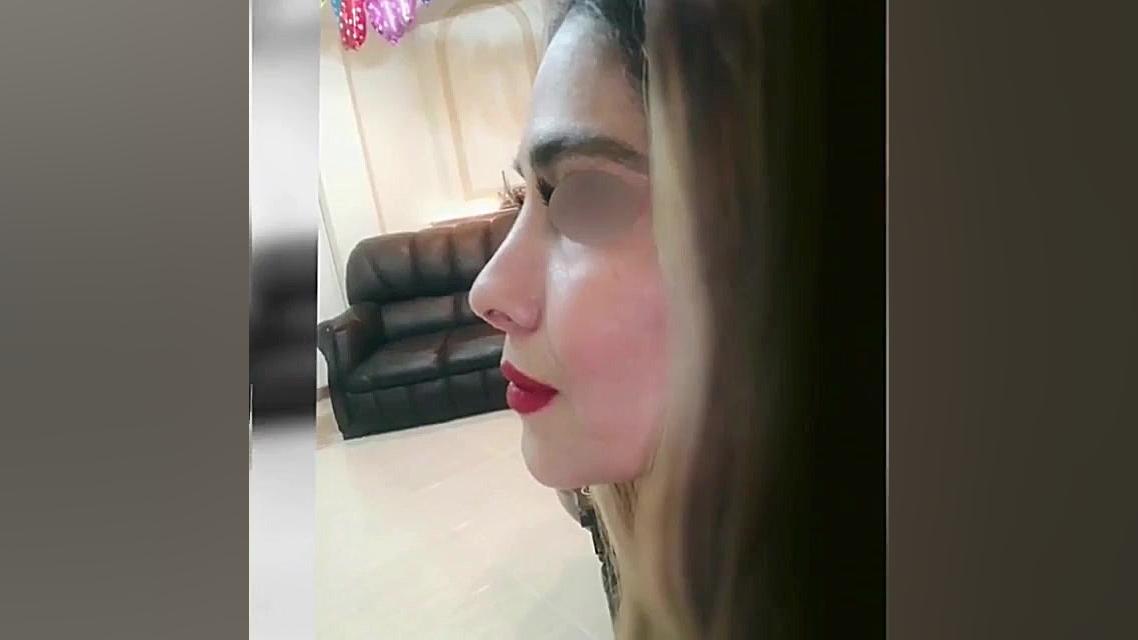 نتیجه جراحی ترمیمی بینی بسیار...