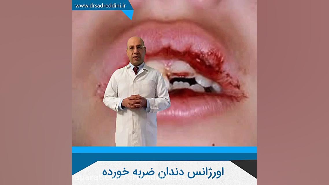 اورژانس دندان ضربه خورده