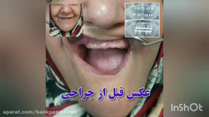 مرکز تخصصی جراحی فک و صورت دکت...