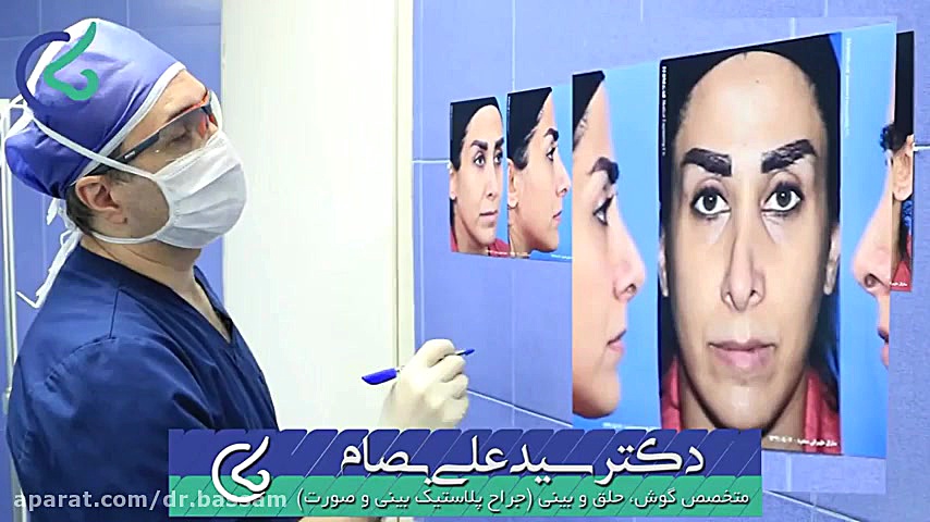 فیلم عمل ترمیم بینی