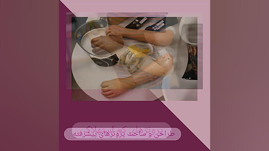 طراحی و ساخت پروتز دست