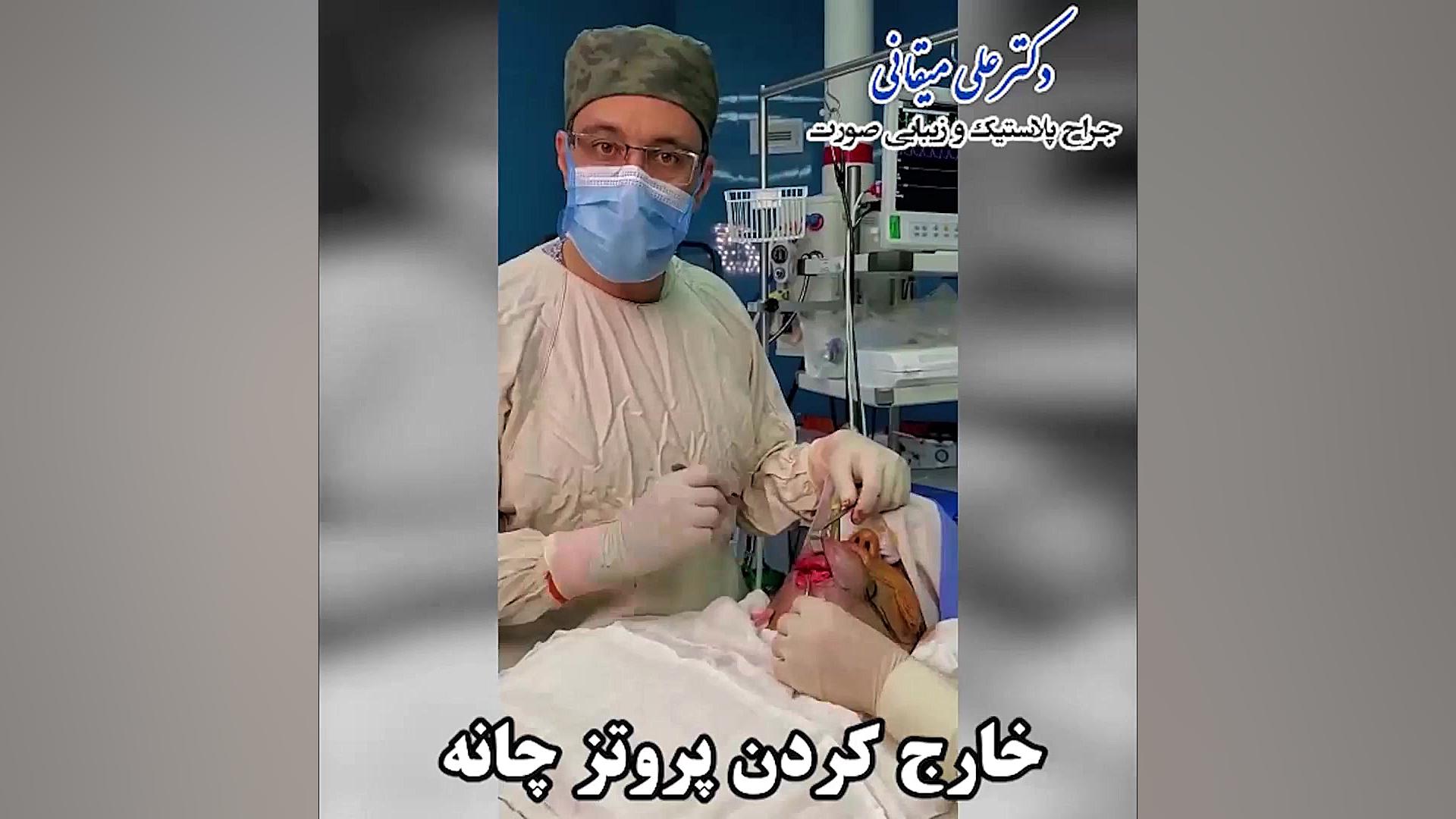 فیلم خارج کردن پروتز چانه