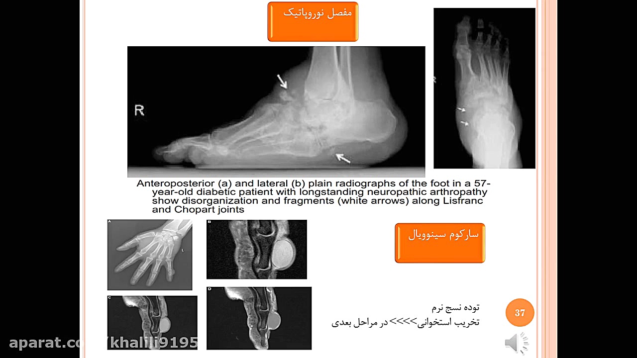 articular disease radiology