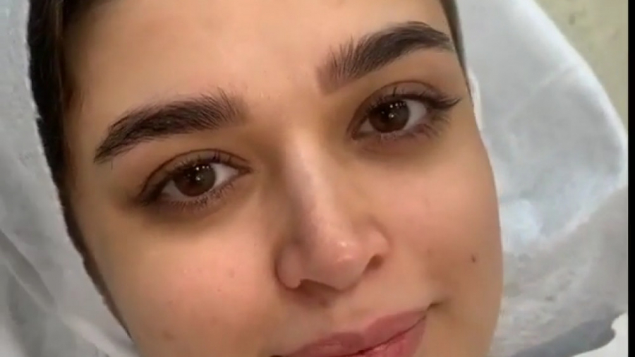 معجزه ای به نام آرایش  قبل و ب...