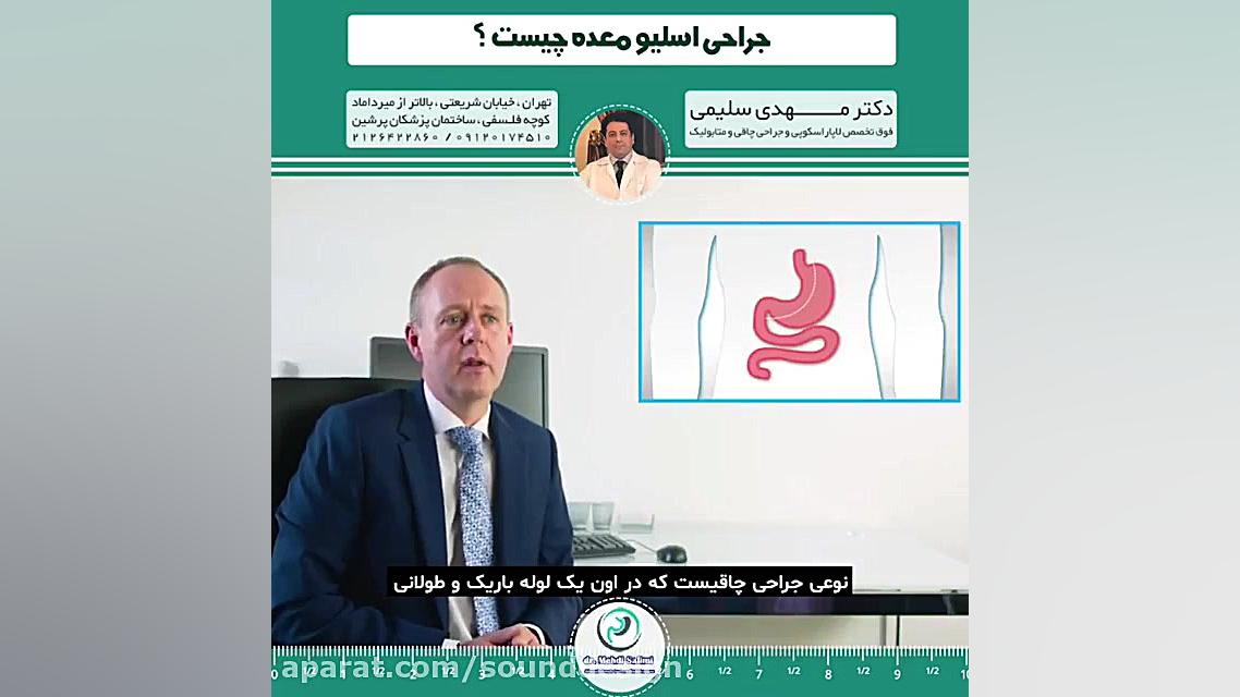 جراحی اسلیو معده چیست؟