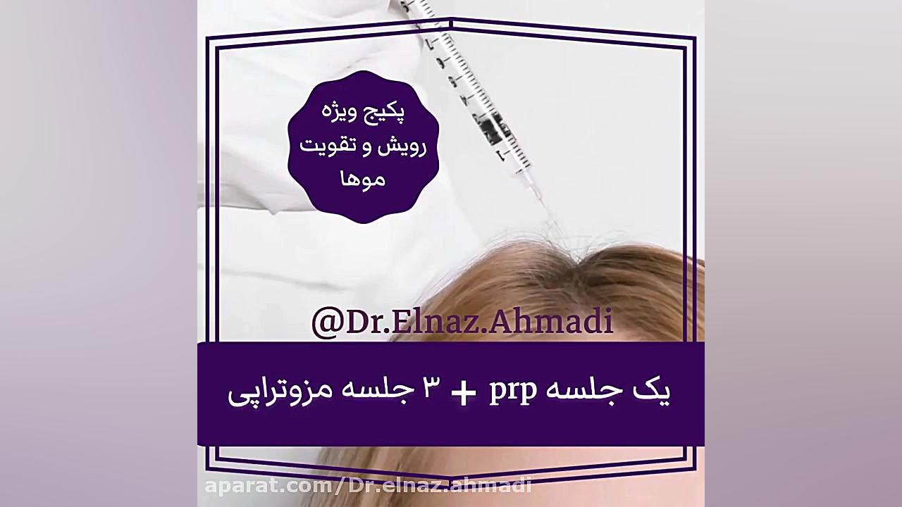 تخفيف پكيج رويش مو