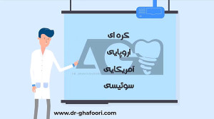 برند ایمپلنت دندانی