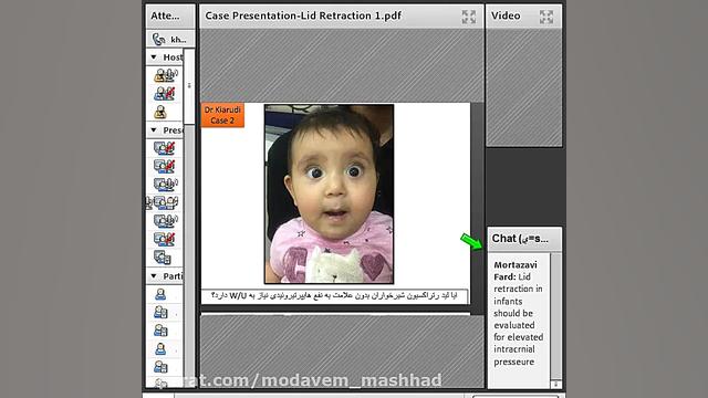 بیماری های غیرتومورال پلک