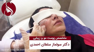 فیلم از بین بردن لک حاملگی (مز...
