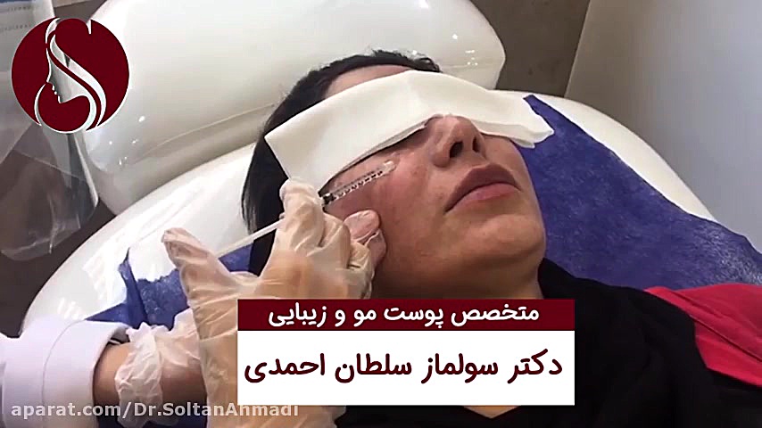 فیلم از بین بردن لک حاملگی (مز...