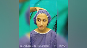 فیلم واقعی جراحی بینی و تغییر...
