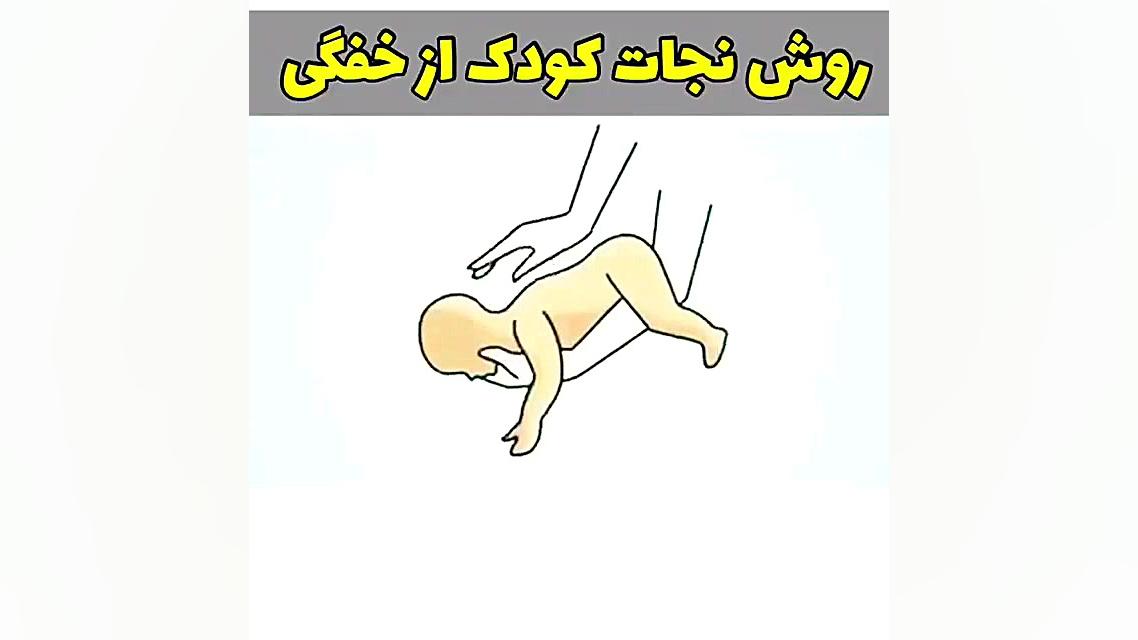 روش نجات کودک از خفگی
