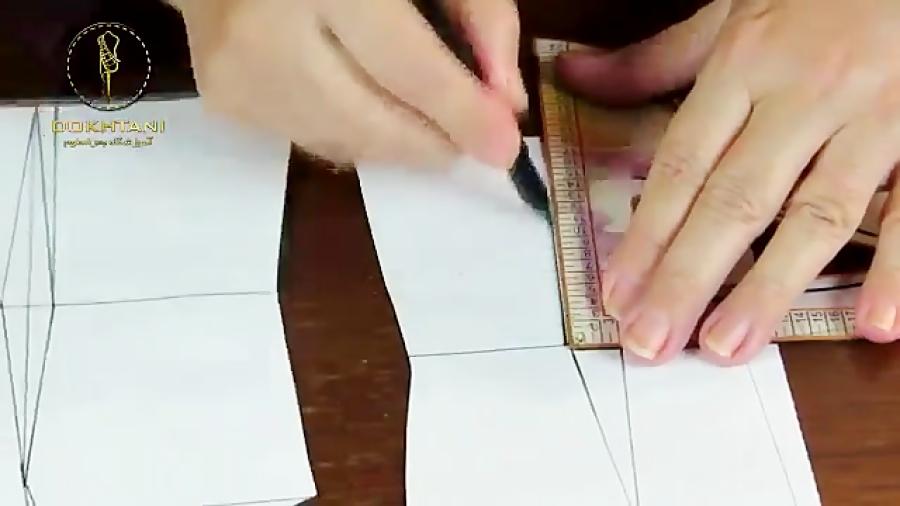 رفع ایراد اندامی باسن کوچک  آم...