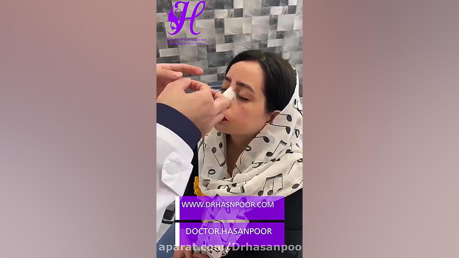 فیلم نحوه ی چسب زدن بینی بعد ا...