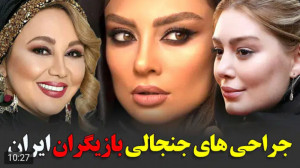جراحی های جنجالی بازیگران زن ا...