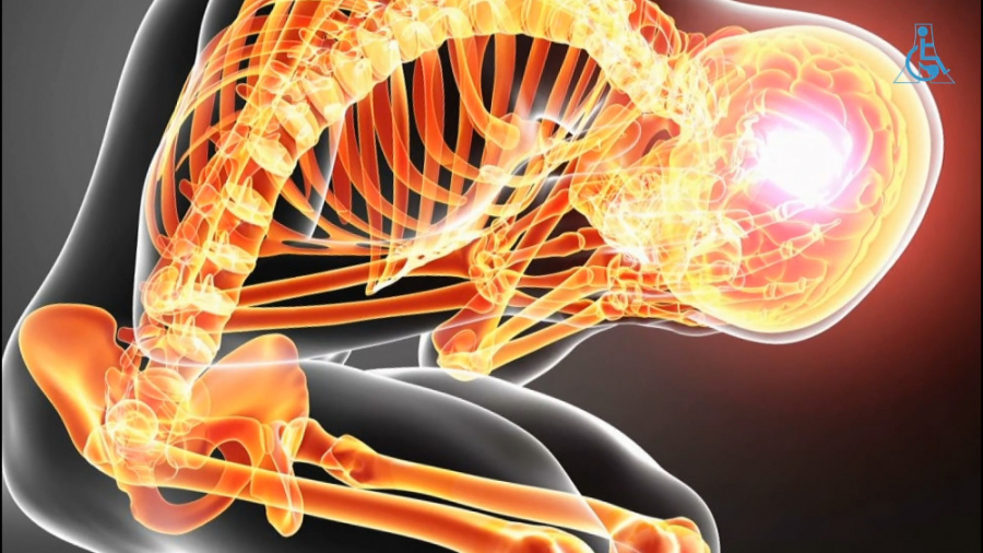 شرایط بهبود درد در افراد دچار...