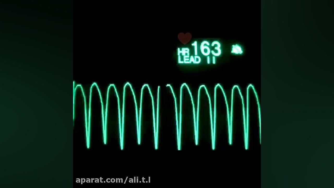 کلیپ زیبای علی دِقان( دل دل بم...