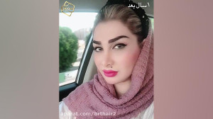 کاشت ابرو