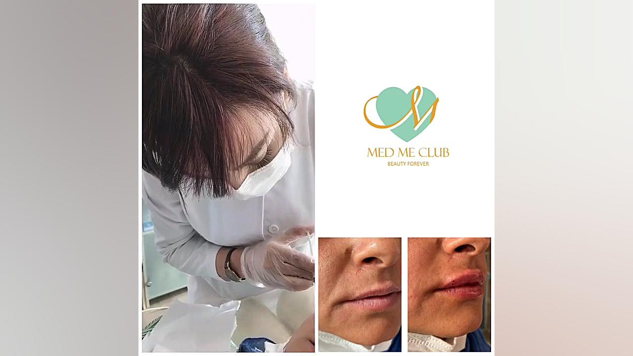 فیلر لب در مجموعه Med Me Club