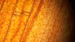 مشاهده جریان خون در زیر میکروس...