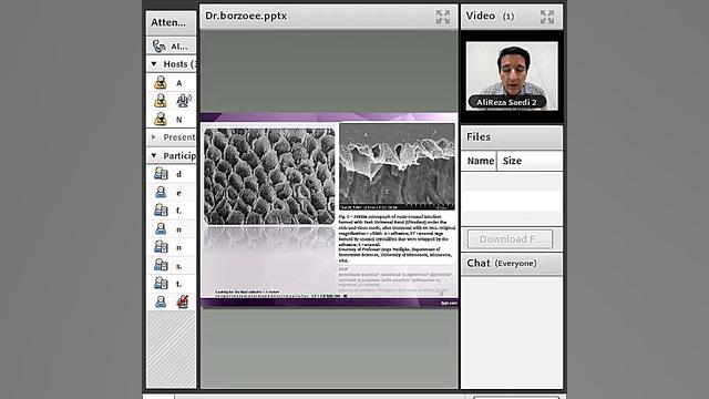 الفبای ترمیم های کامپوزیت