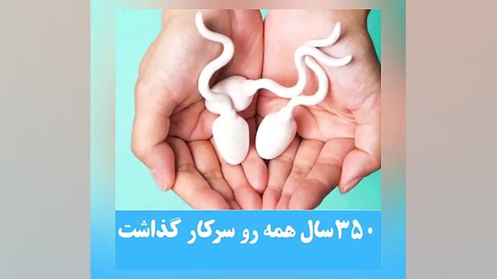 حركت اسپرم به سمت تخمك