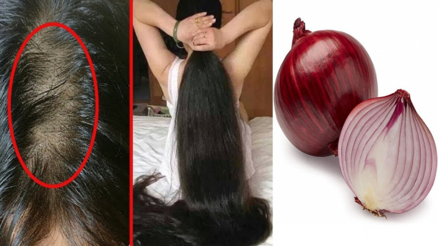 تقویت ریشه مو و رنگ طبیعی مو ب...