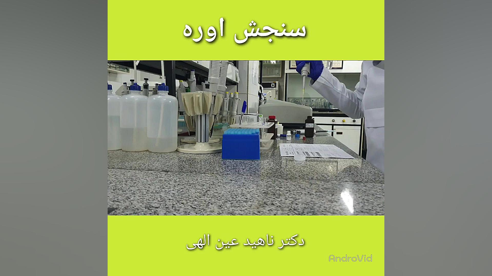 سنجش اوره (BUN) به روش آنزیمی