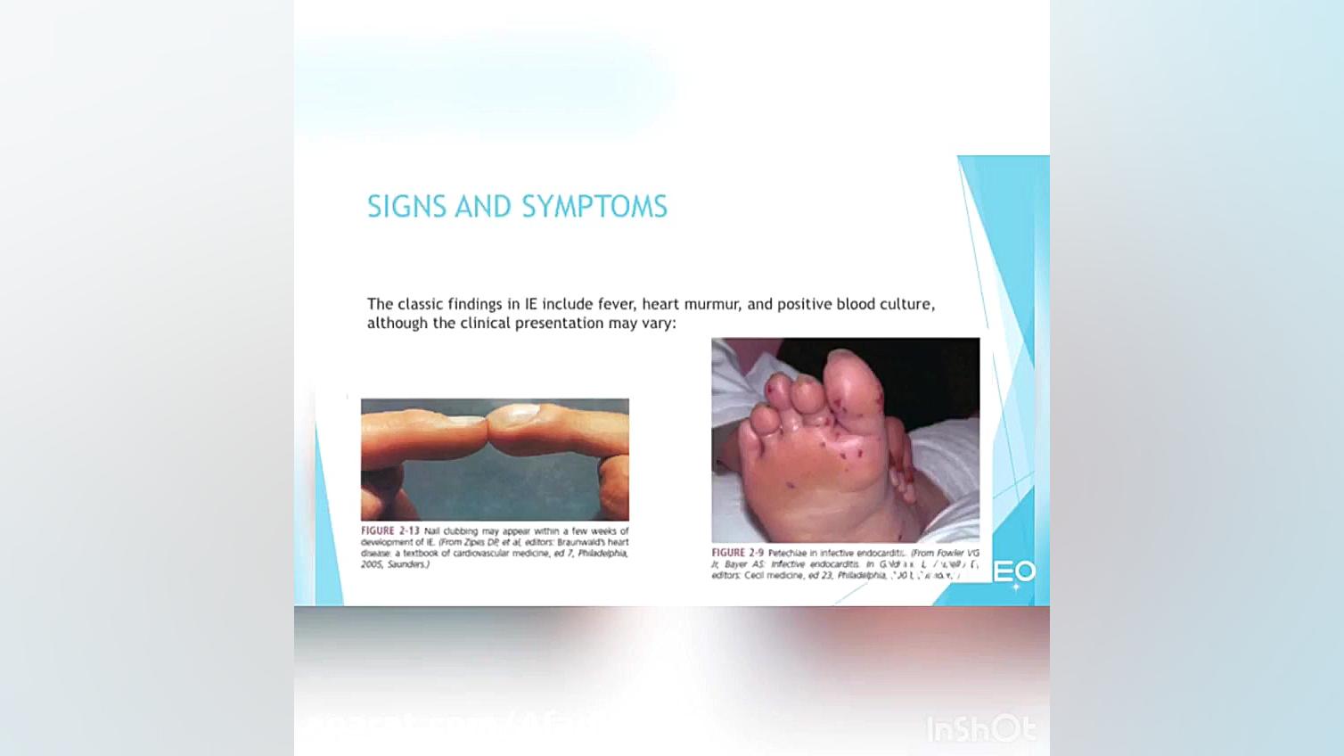 دندانپزشکی در بیمار دارای دریچ...