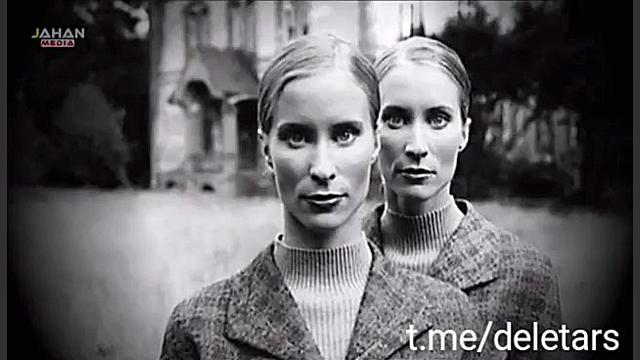 کسی به این دختر نزدیک نمی شود...