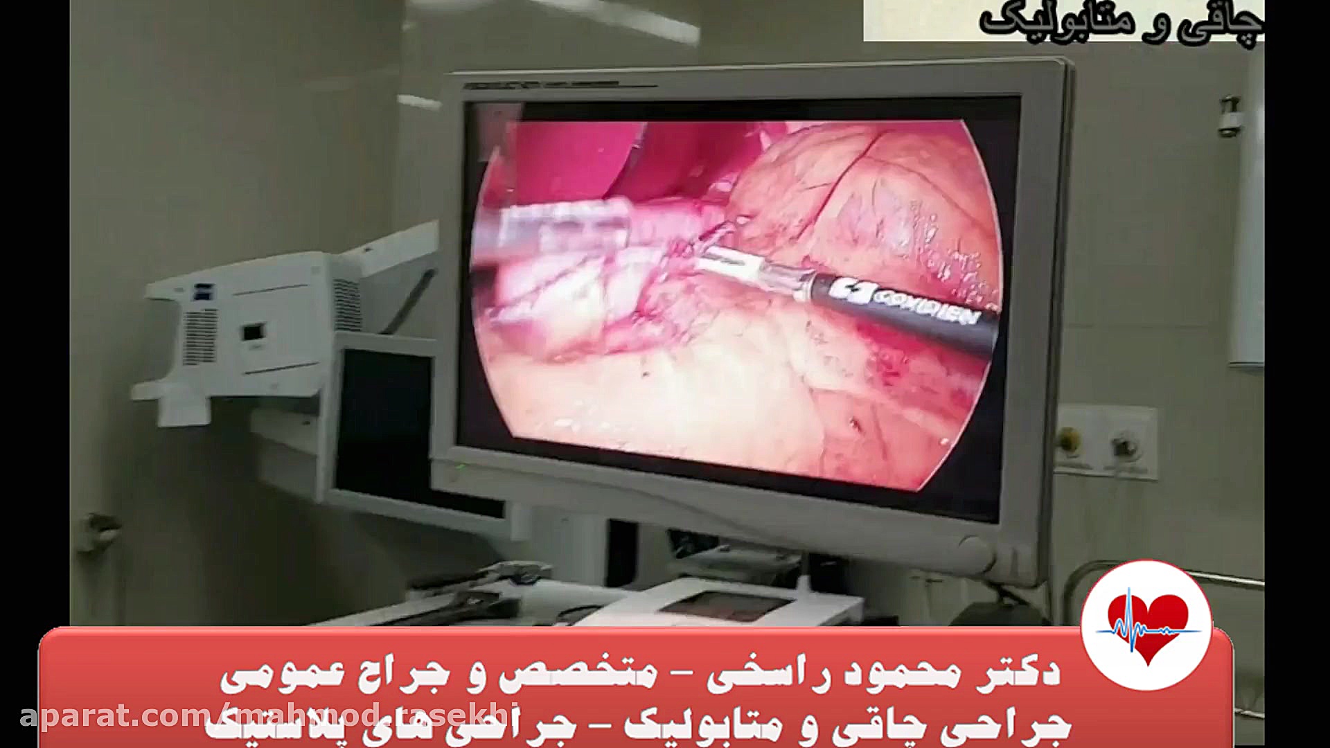 فیلم اسلیو معده ( جراحی چاقی )