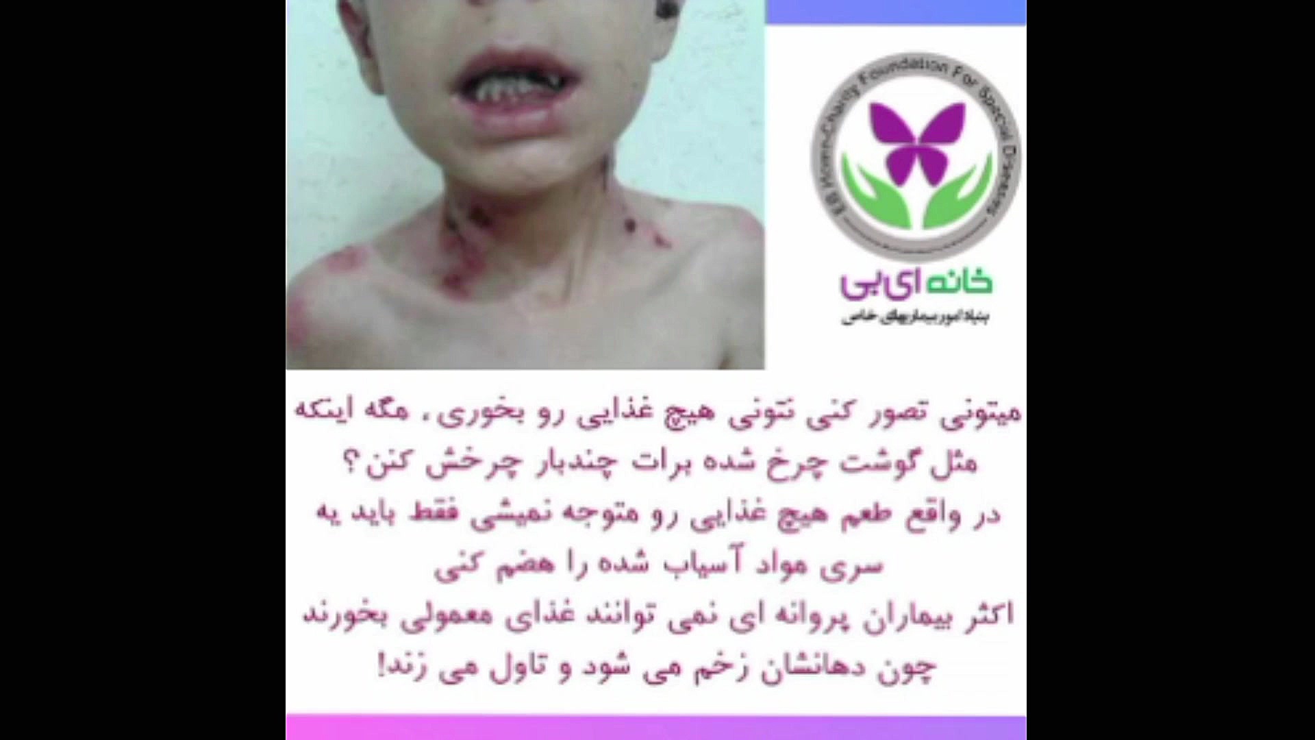 پروانه‌ی ویلاشهر