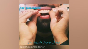 الو دکتر اسنپ اسمایل، روشی جدی...