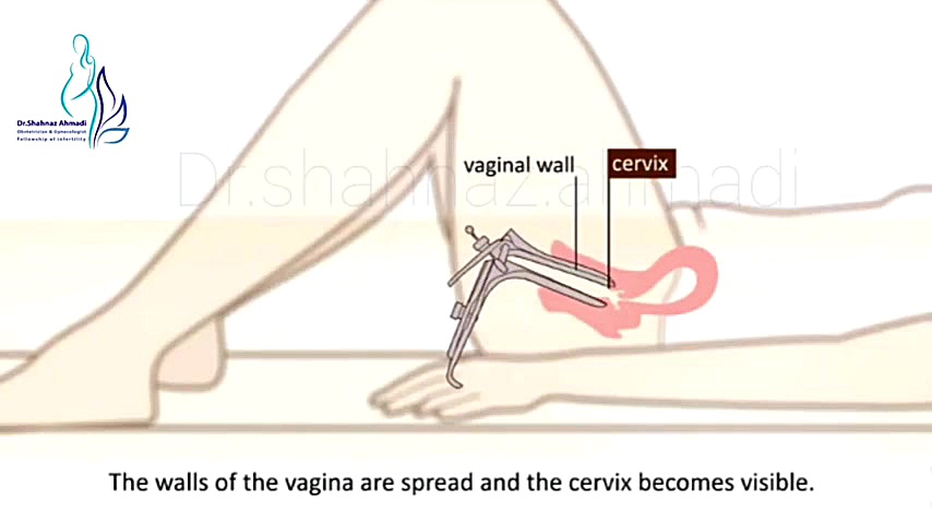 فیلم تست پاپ اسمیر