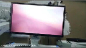 عمل کله سیستکتومی (برداشتن کیس...