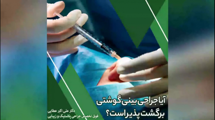 آیا بینی گوشتی بعد از عمل برگش...