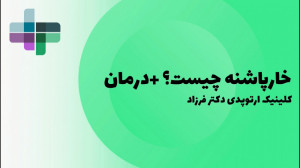 خارپاشنه فرزاد
