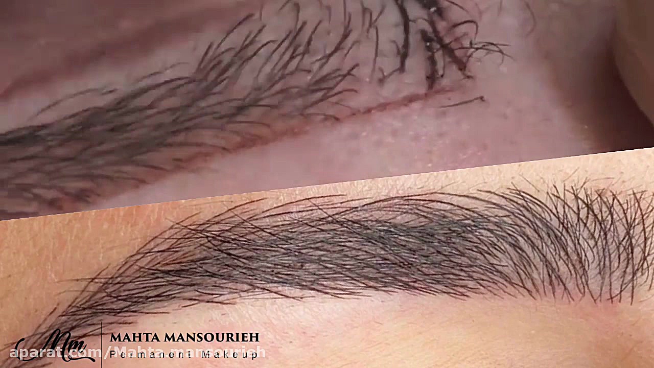 میکروبلیدینگ ابرو به روش فیبرو...