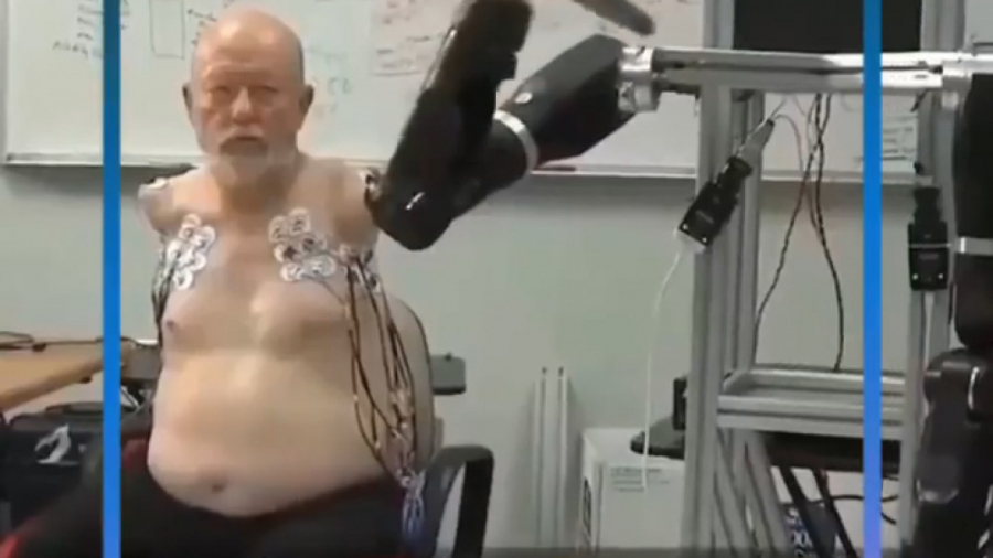 اعضای مصنوعی آینده