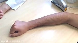 آموزش رگ گیری برای تزریق وریدی