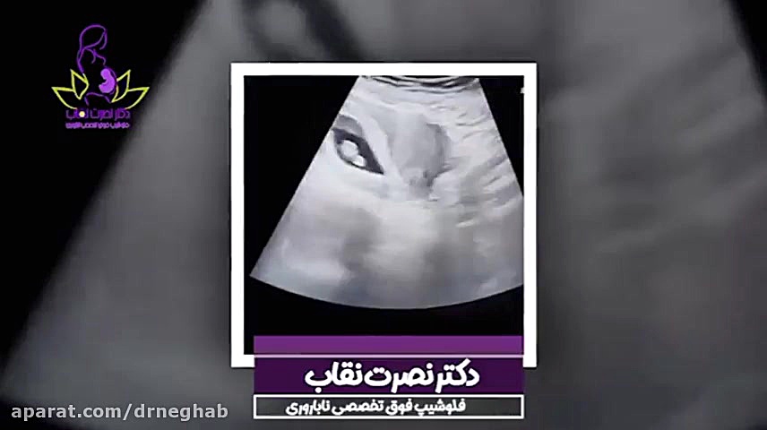 فیلم سونوگرافی حاملگی دوقلویی