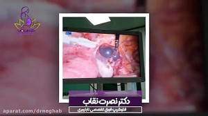 فیلم حاملگی خارج از رحمی
