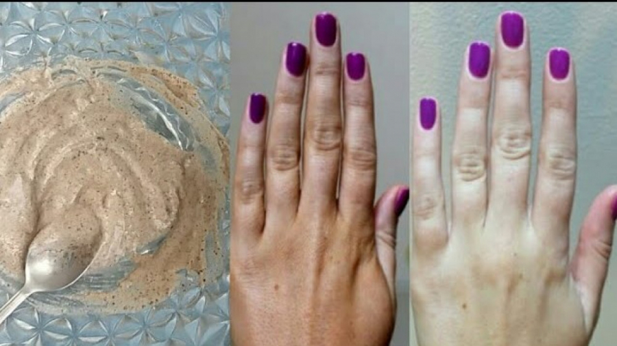 سفید شدن فوری پوست را با این ف...