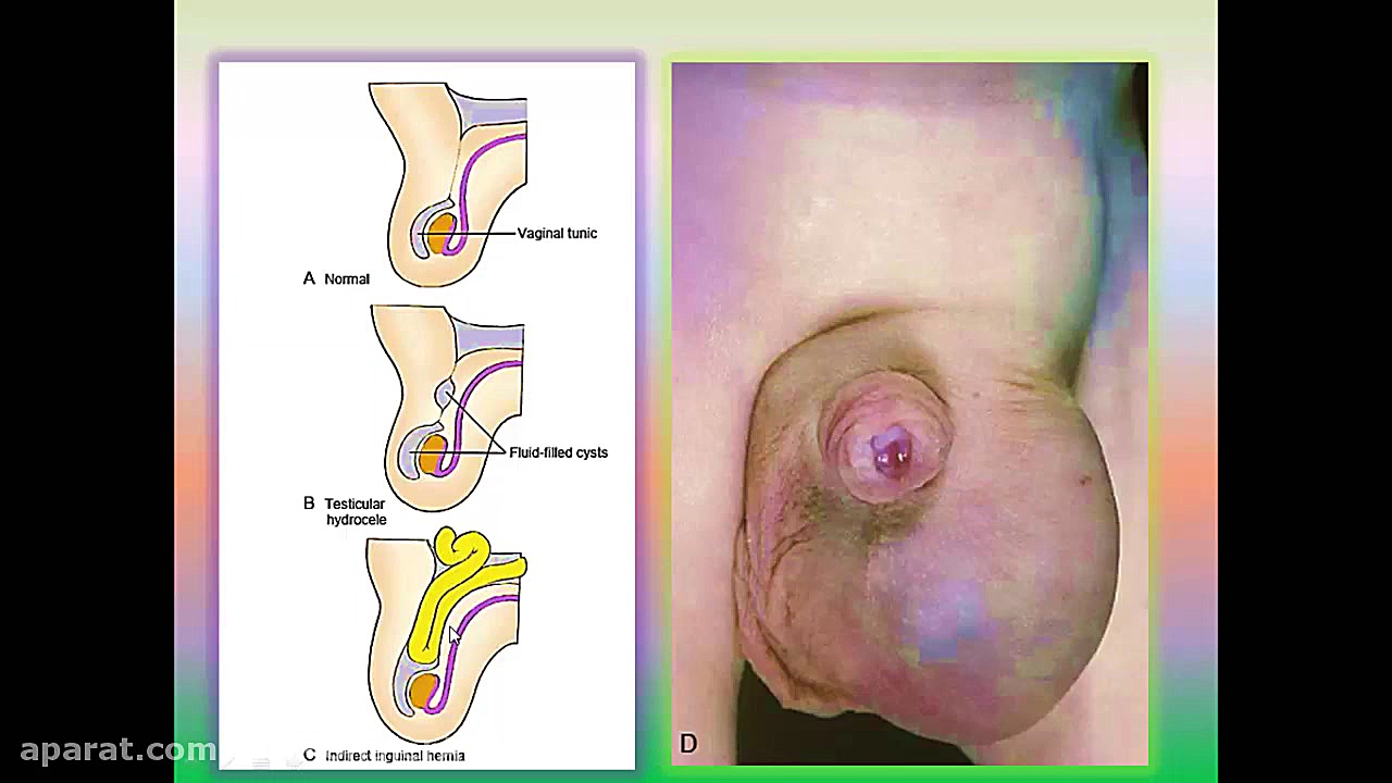 جنین شناسی سیستم تناسلی