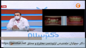 درمان دندان های شلوغ  متخصص ار...