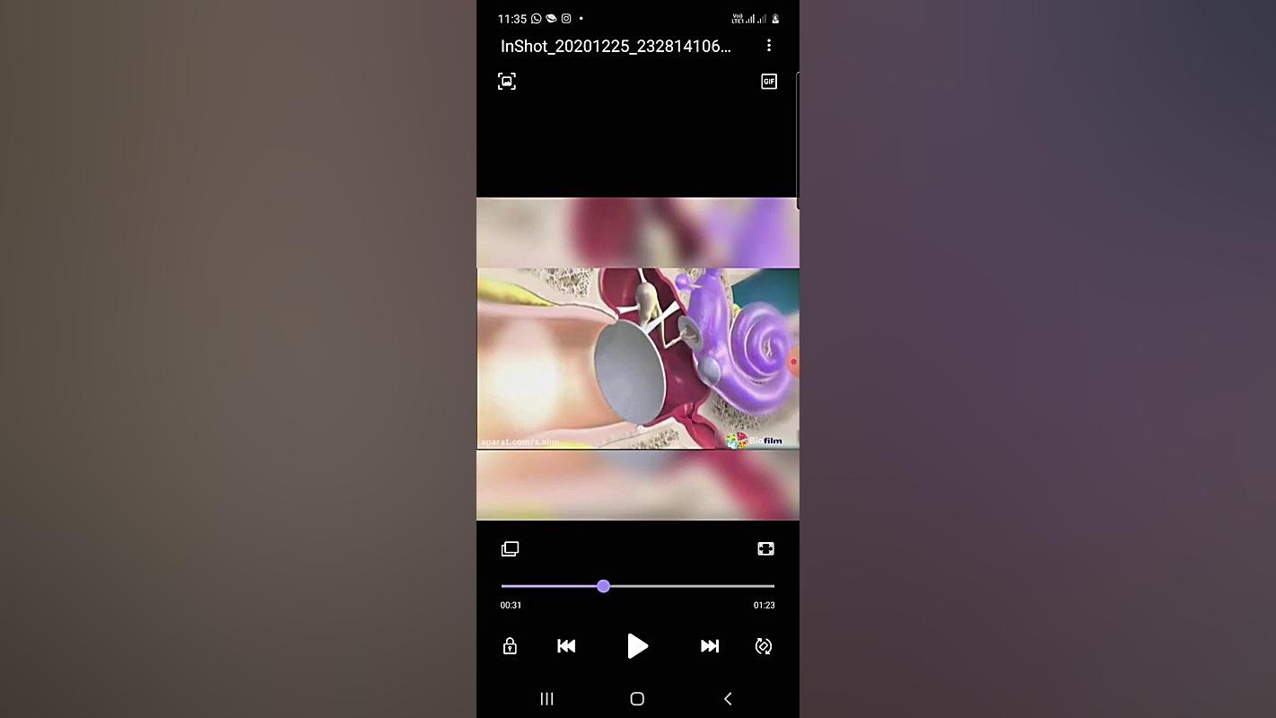 بررسی ساختار گوش انسان