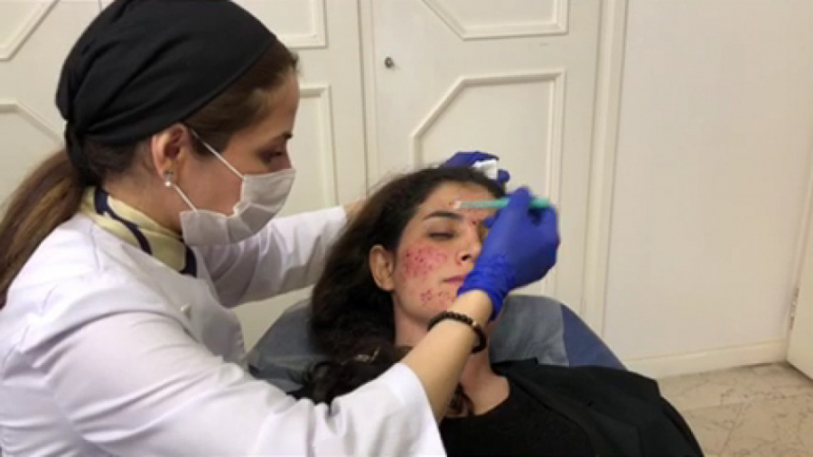 پانچ جای جوش موگه کلینیک