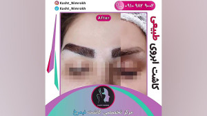 کاشت ابروی طبیعی