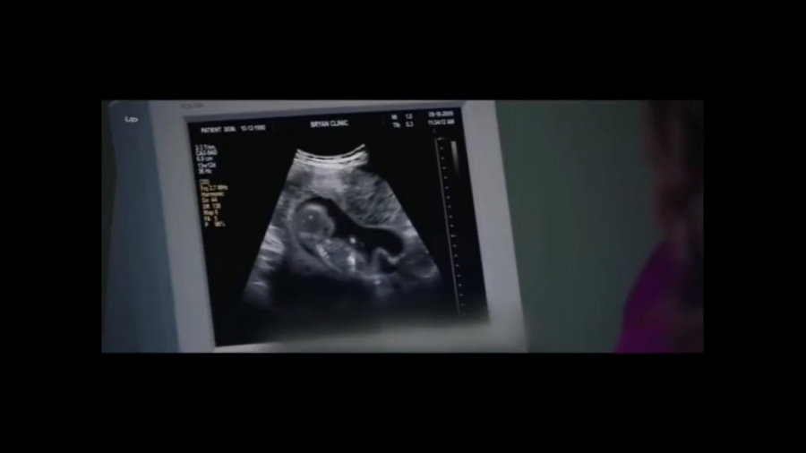 عمل وحشیانه سقط جنین